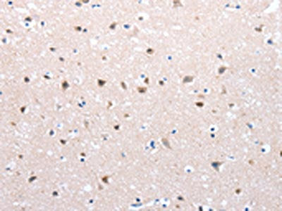 FOXD2 Antibody