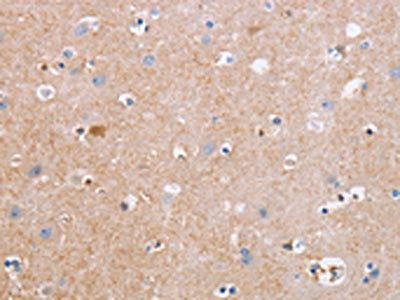 CDC7 Antibody