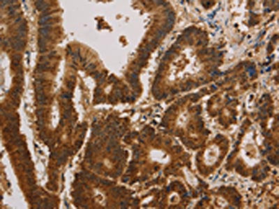 CSNK2B Antibody