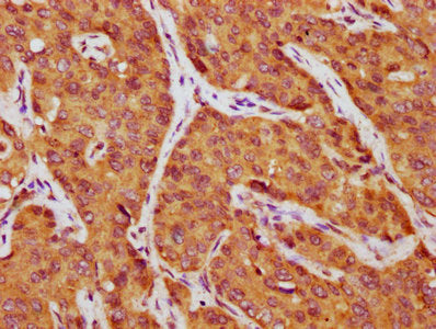 AFP Antibody