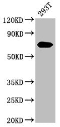 AFP Antibody
