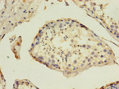 HAVCR1 Antibody