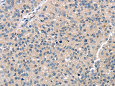 TTC23 Antibody