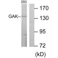 GAK Antibody