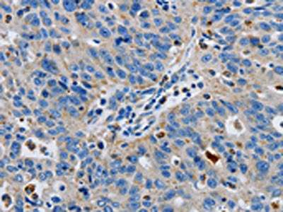 GRIA3 Antibody