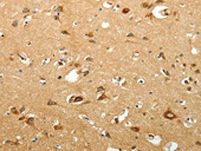 SIRT3 Antibody