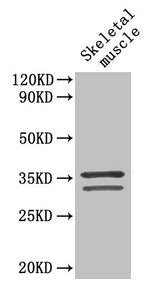 TNNT2 Antibody