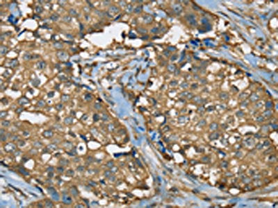 SEZ6L Antibody