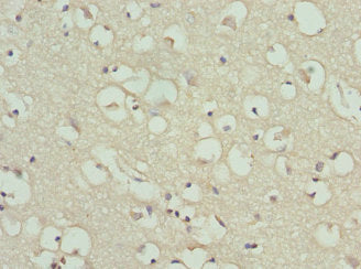 PYGB Antibody