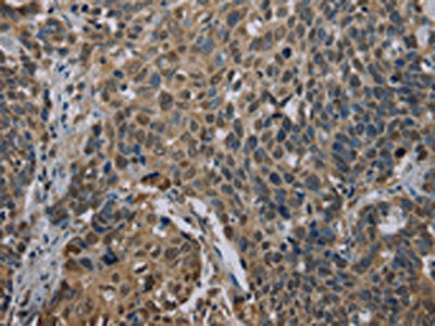 UBP1 Antibody