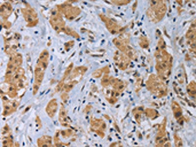 CLEC1A Antibody
