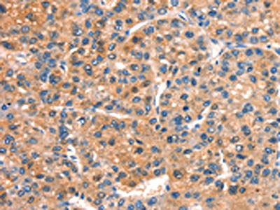 DOCK1 Antibody