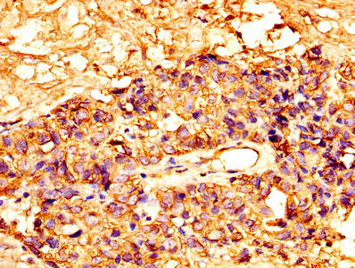 MSLN Antibody