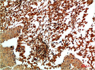 MAPK9 Antibody