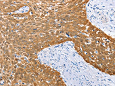 IRF6 Antibody