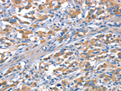 CDH5 Antibody