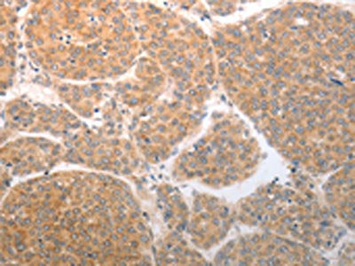 NQO1 Antibody