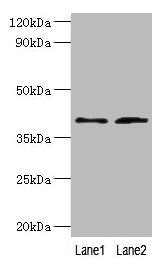 DCN Antibody