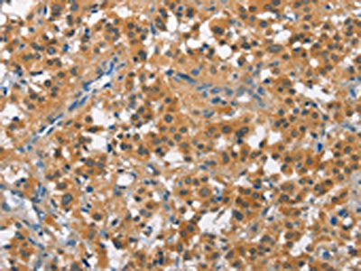 CUL7 Antibody