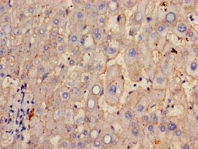 GGT1 Antibody