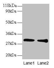 GSTP1 Antibody