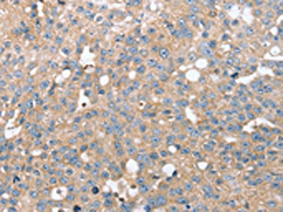 STK36 Antibody