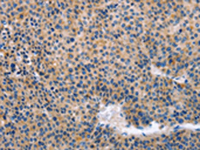 KLF15 Antibody