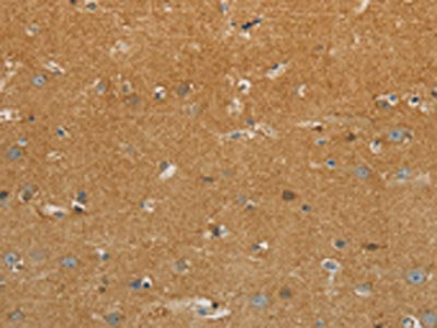 GJB6 Antibody