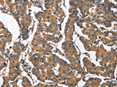 BNIP2 Antibody