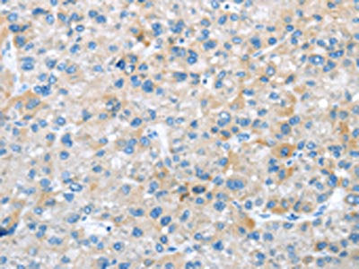 TRIM47 Antibody