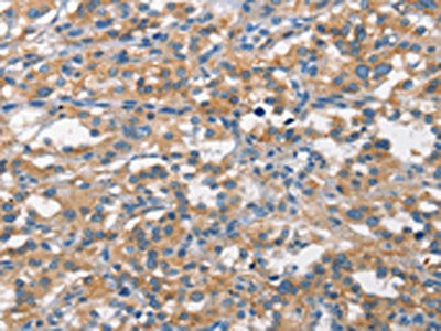 ALCAM Antibody