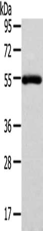 FOXC1 Antibody