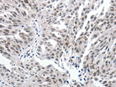 PKD2 Antibody