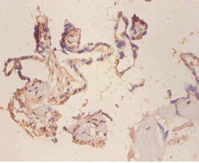 MCAM Antibody