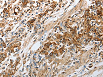 NPY1R Antibody