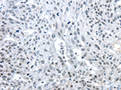 TRIM33 Antibody