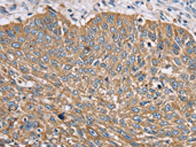 TFRC Antibody
