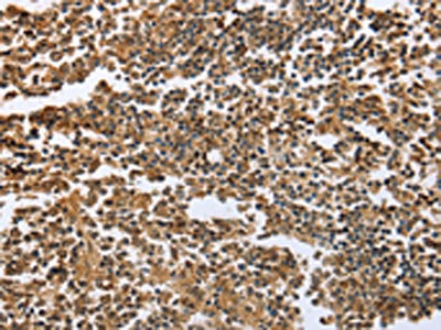 ECE1 Antibody