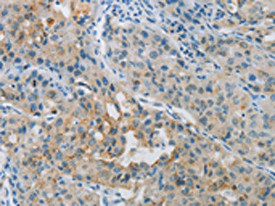 PRKCA Antibody