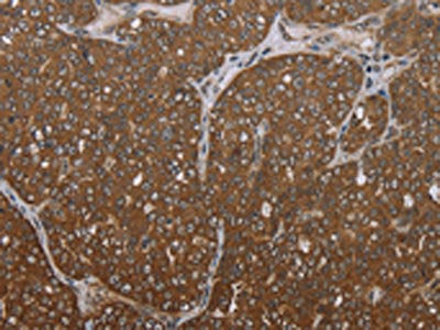 FOLH1B Antibody