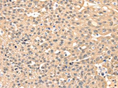 MAP2K3 Antibody