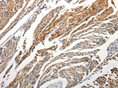STAT5B Antibody