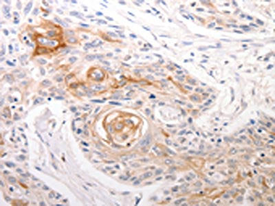 DFFB Antibody