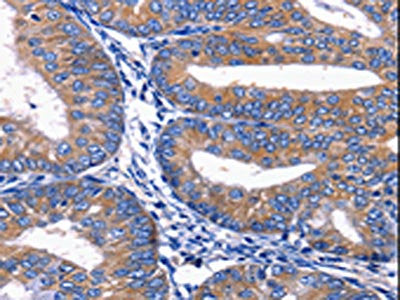 PLEKHO1 Antibody