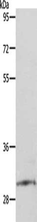 SNAI2 Antibody