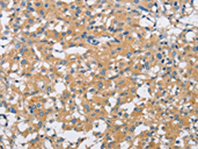 SH3GLB1 Antibody