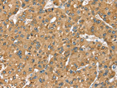 SEC14L2 Antibody