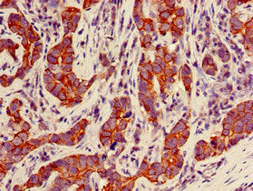 KRT18 Antibody, Biotin conjugated