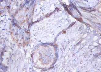 GOLM1 Antibody