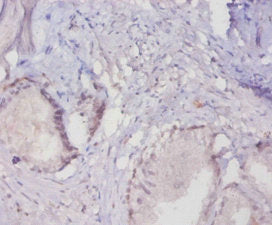 MUC16 Antibody